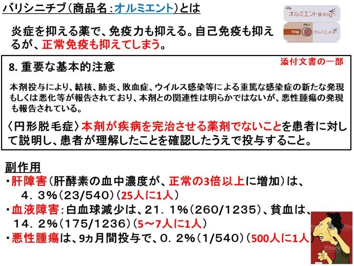 円形脱毛症　病院